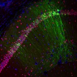Microscopio confocal espectral Fluoview 1000 Olympus